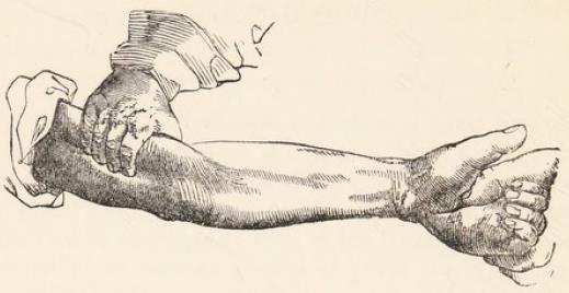 Fig.3.